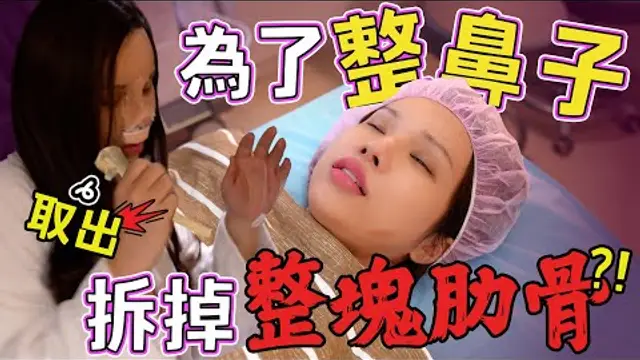 把肋骨敲下來裝在鼻子裡？！鼻子會變得跟骨頭一樣硬嗎？？ 小A辣